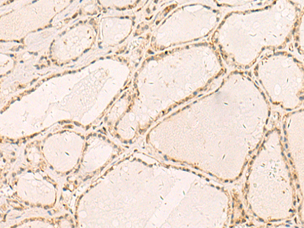 RFX6 Antibody