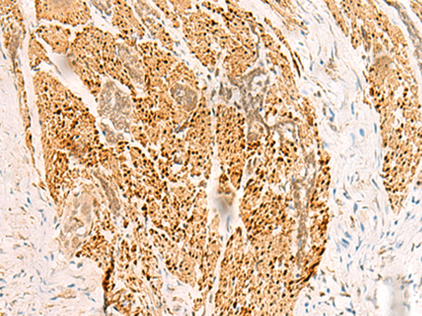 RFX6 Antibody