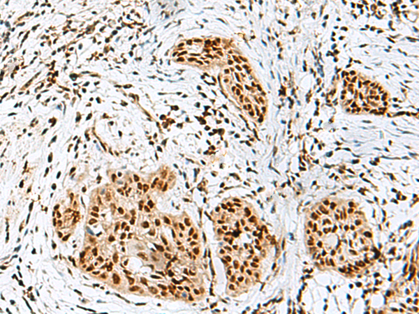 RBM10 Antibody