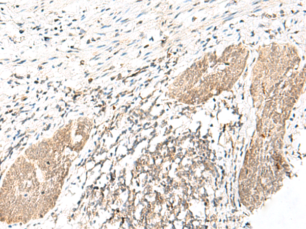 DHX36 Antibody