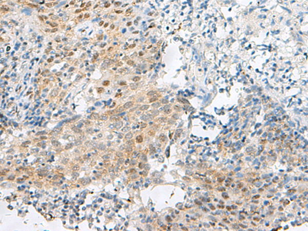 DHX36 Antibody