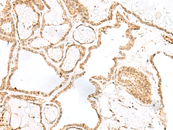 RPP14 Antibody