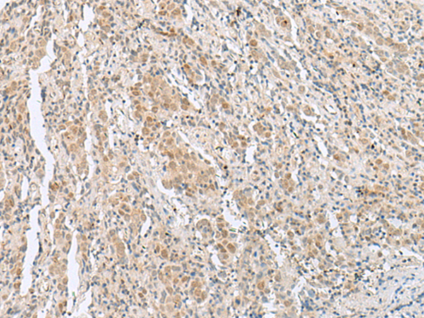 HIST1H2BK Antibody