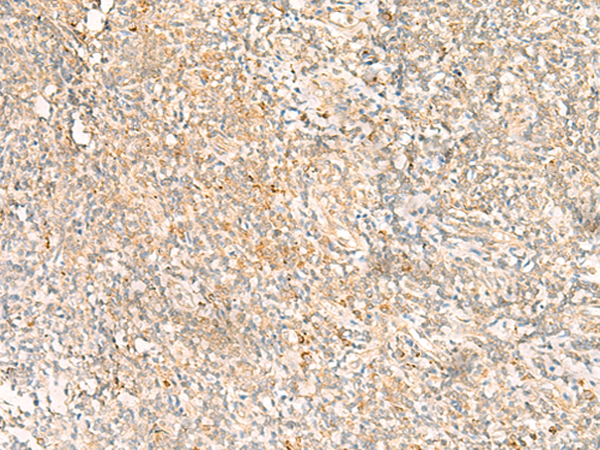 MTHFD2L Antibody