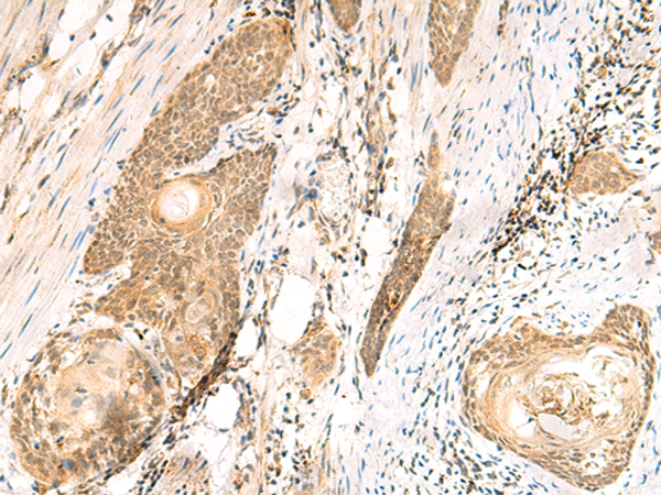 MTHFD2L Antibody