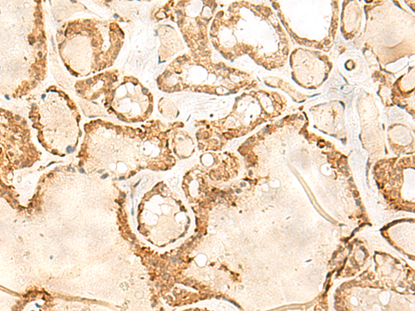 JPT1 Antibody