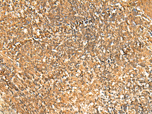 GSG1L Antibody