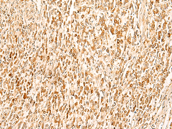 SMUG1 Antibody