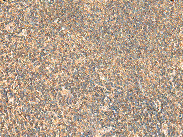PDAP1 Antibody