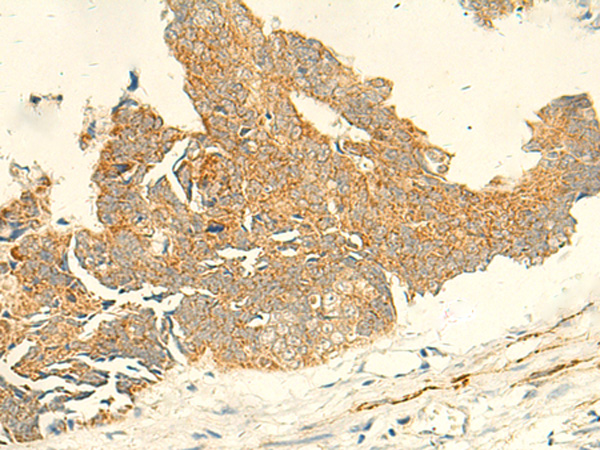 TMEM9 Antibody