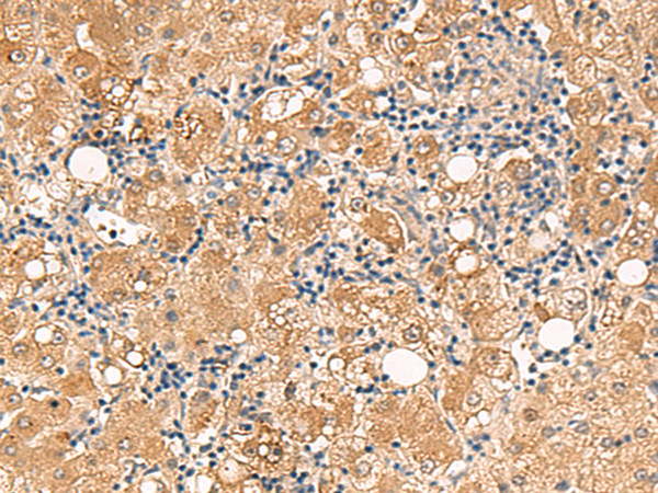 FUNDC2 Antibody