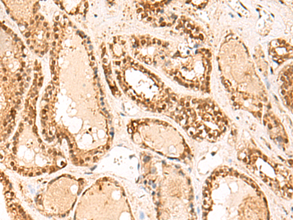 FUNDC2 Antibody
