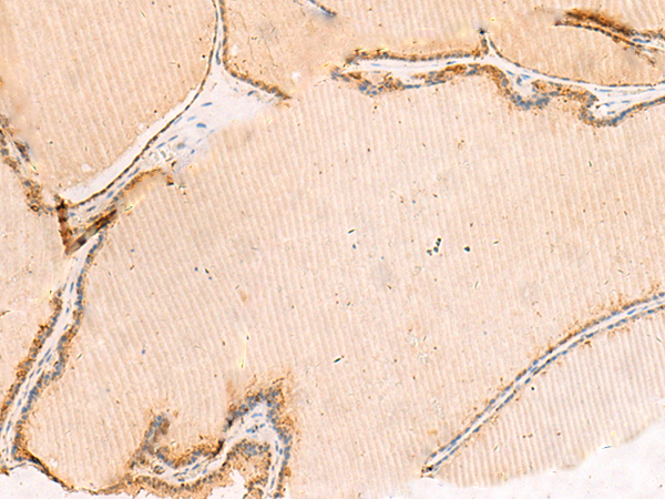 DNAJC12 Antibody