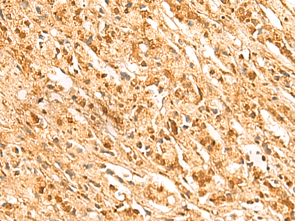 SSSCA1 Antibody
