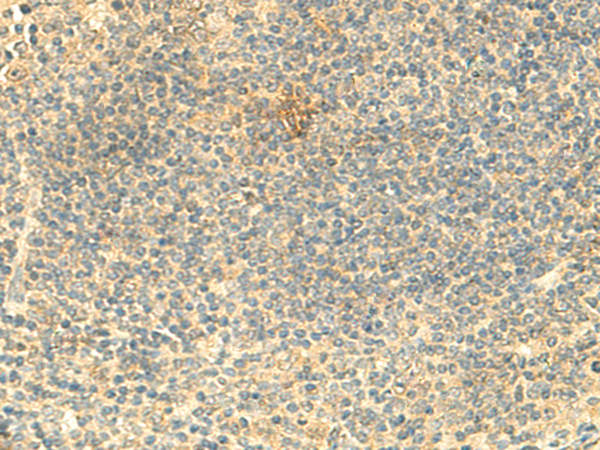 ARL4D Antibody