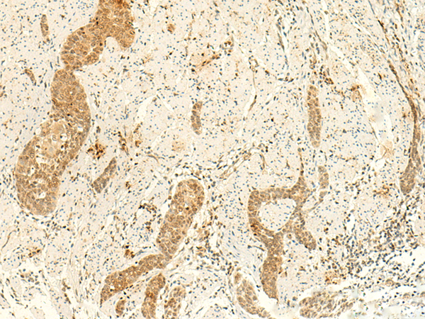 ARL4D Antibody