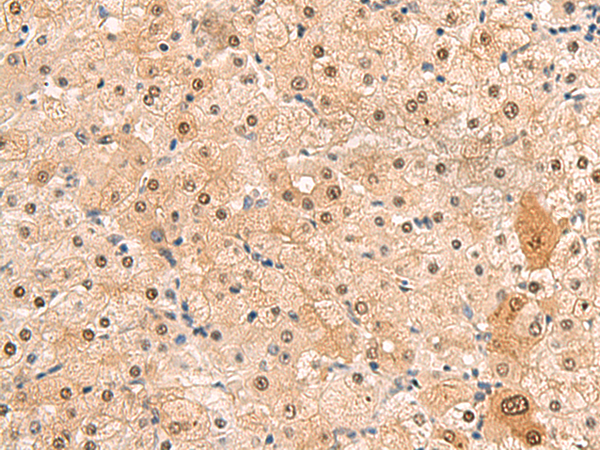 HEBP2 Antibody