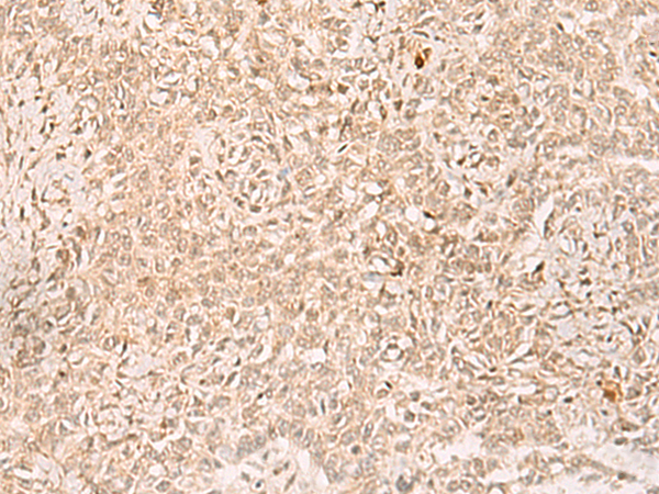 POP4 Antibody