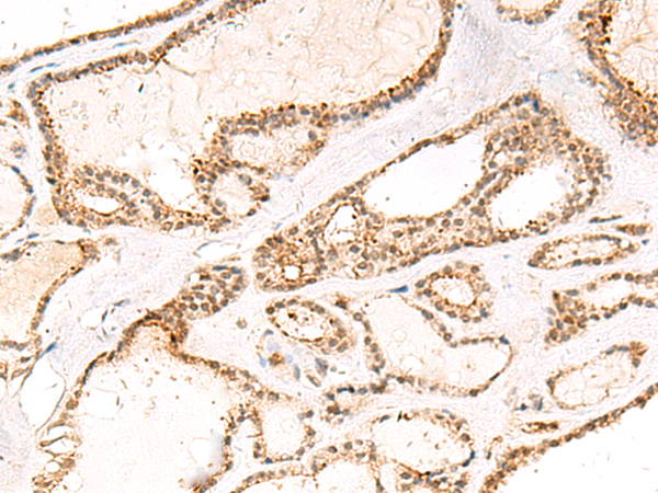 DCAF10 Antibody