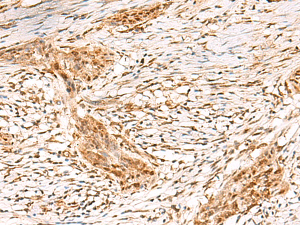 DCAF10 Antibody