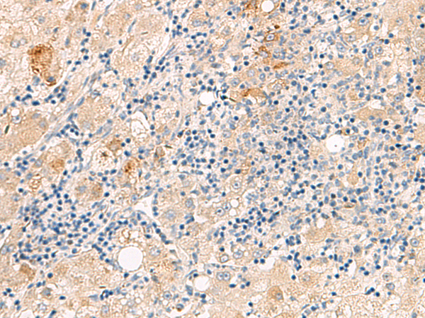 THNSL1 Antibody