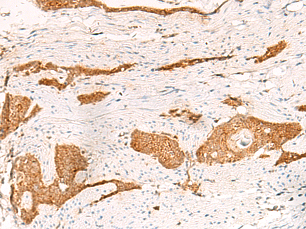THNSL1 Antibody