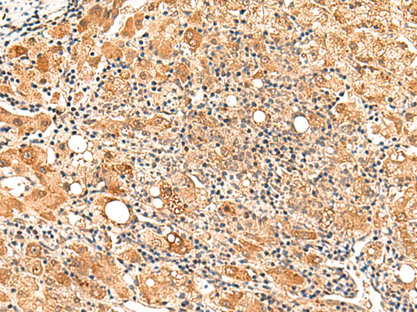 PAFAH1B2 Antibody