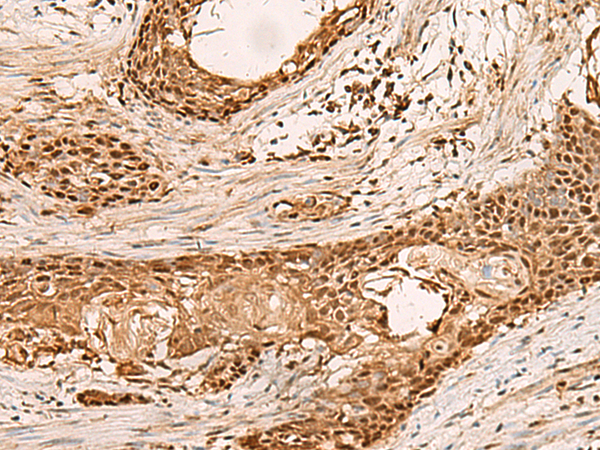 PAFAH1B2 Antibody