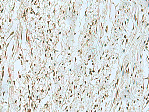 THTPA Antibody