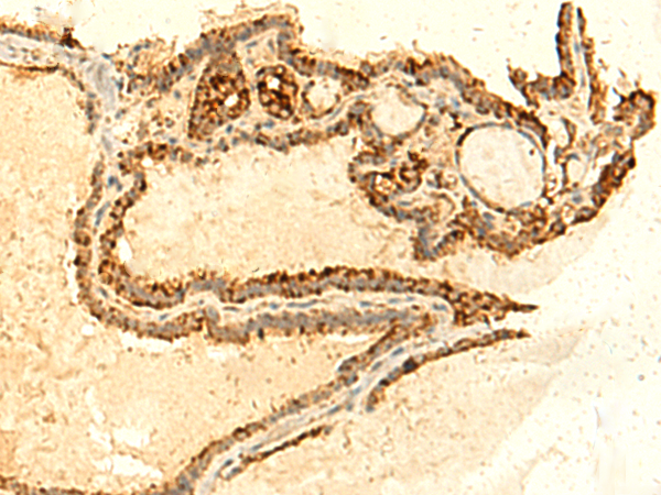 UNKL Antibody