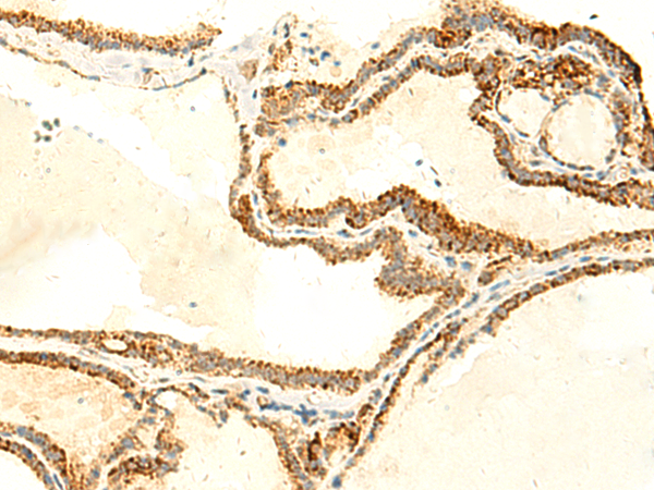 NAPRT Antibody