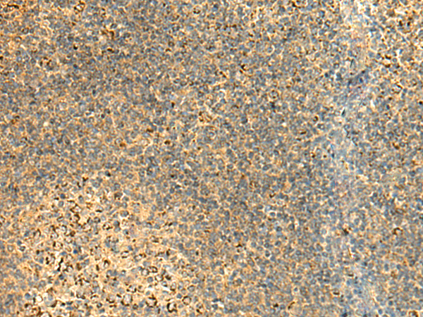 ATP5PD Antibody