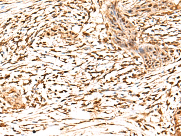 RETREG1 Antibody