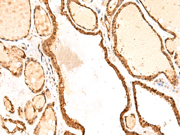 RETREG1 Antibody