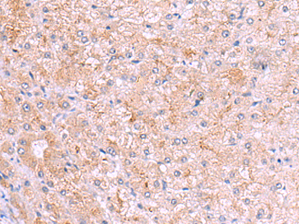 ASTE1 Antibody