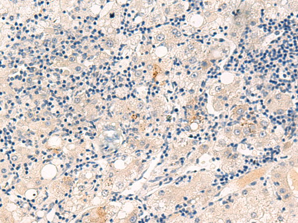 CYYR1 Antibody