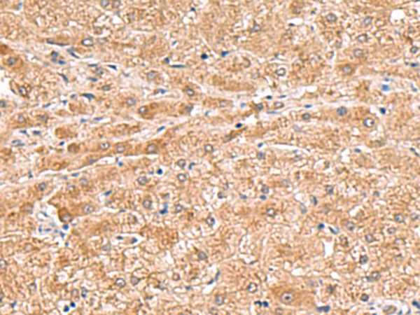 HMGCLL1 Antibody