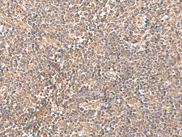 TRUB1 Antibody