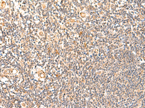 GPD1L Antibody
