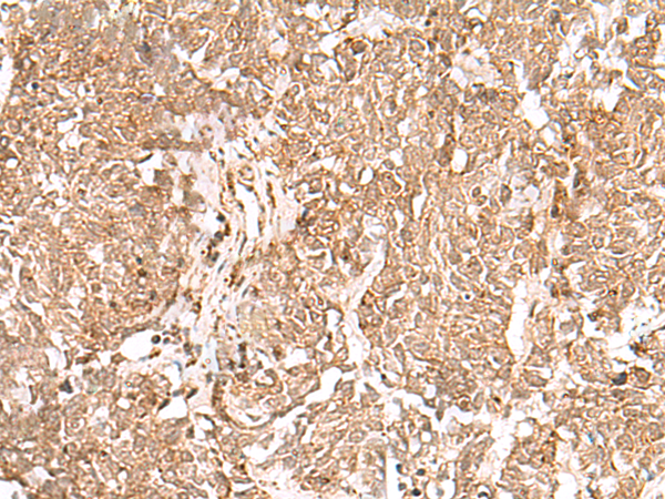 GMPPB Antibody