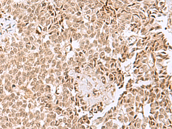 ELAC1 Antibody