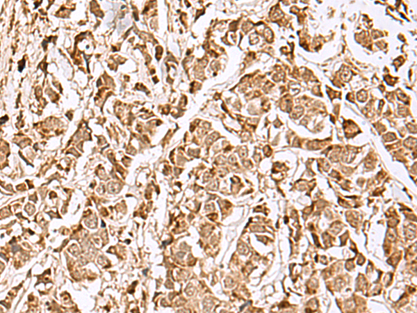 MECR Antibody