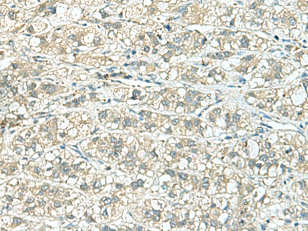 TENT5C Antibody