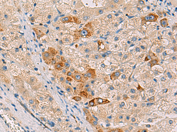 RMDN2 Antibody