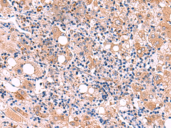 LIPA Antibody