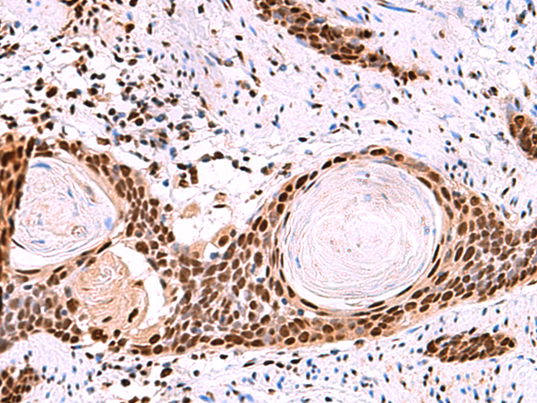 SF3B3 Antibody