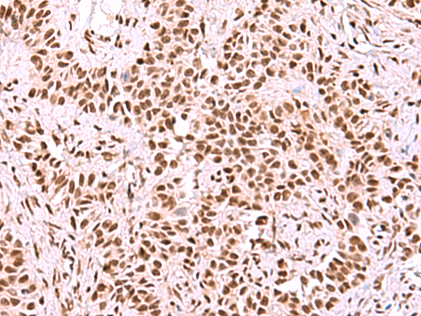SF3B3 Antibody