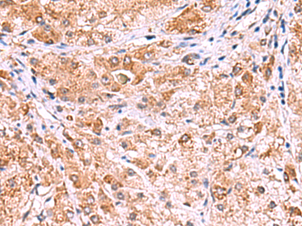 UXS1 Antibody