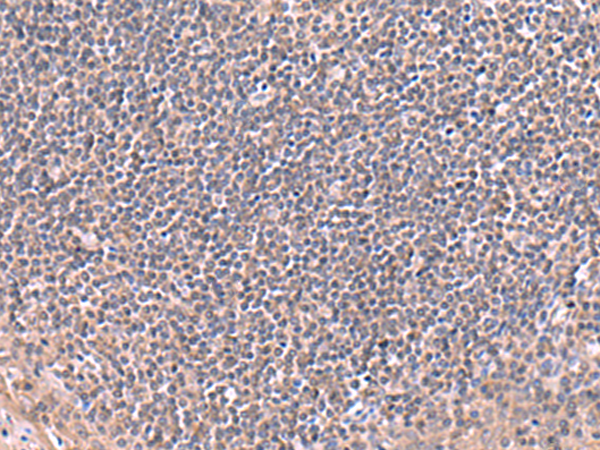 RIC8A Antibody