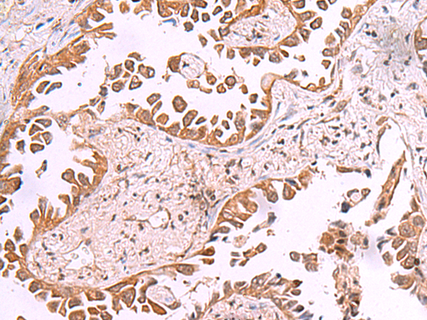 AK9 Antibody